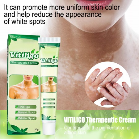 Natural Skin Spot Care Cream