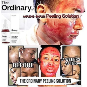 Ordinary Face Makeup Peeling Solution AHA 30% + BHA 2% Acne Removing Serum Repair Hyaluronic Acid Face Skin Care 30m
