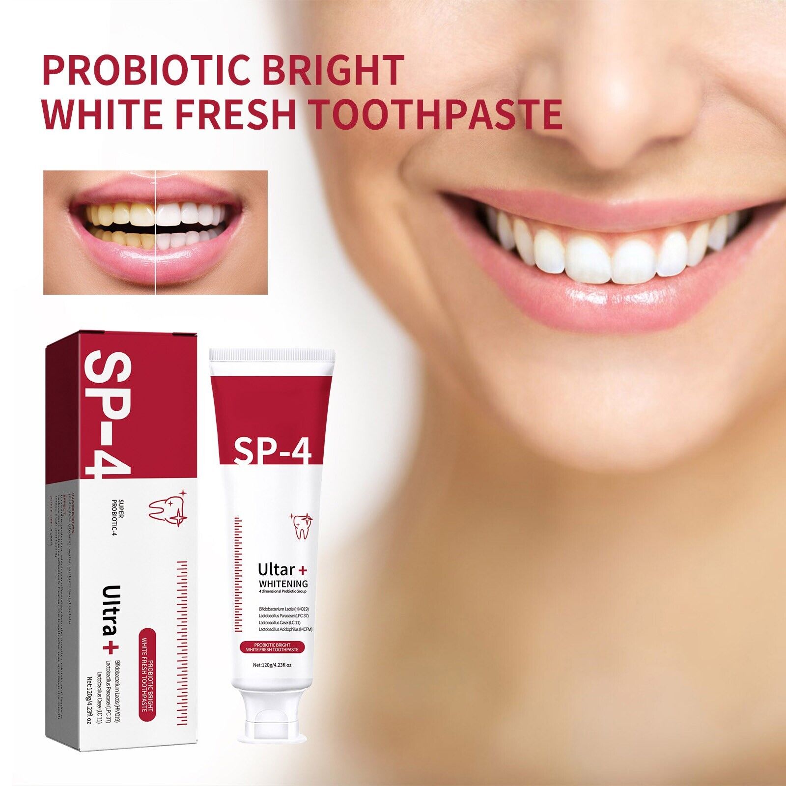 SP-4™ Probiotic Whitening Toothpaste (120 GM)