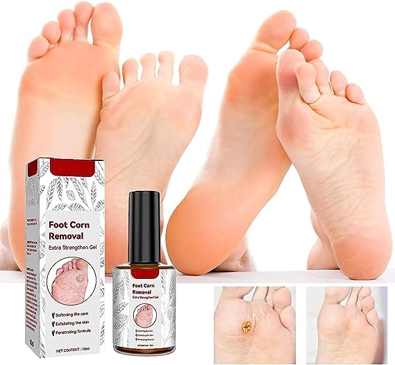 Foot Corn Removal Extra Strengthen Gel(10 ML)