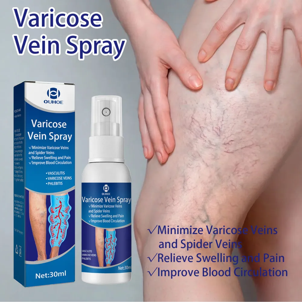 OUHOE Varicose Veins Treatment Spray