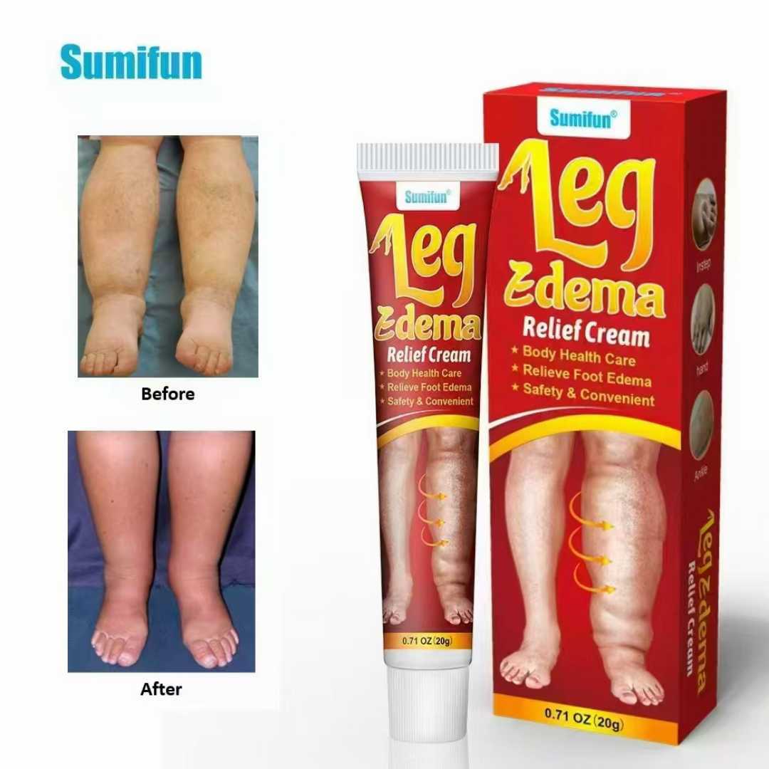 Sumifun Leg Edema Relief cream.